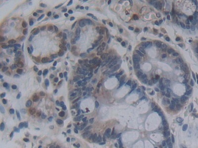 Immunohistochemistry (Formalin/PFA-fixed paraffin-embedded sections) - Anti-FGF12 antibody (AB231956)