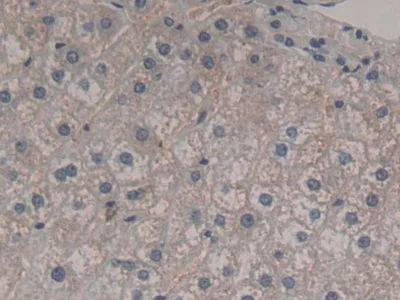 Immunohistochemistry (Formalin/PFA-fixed paraffin-embedded sections) - Anti-FGF12 antibody (AB231956)