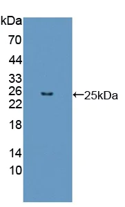Western blot - Anti-FGF12 antibody (AB231956)