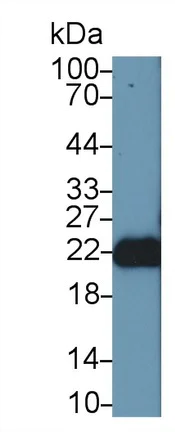 Western blot - Anti-FGF12 antibody (AB231956)