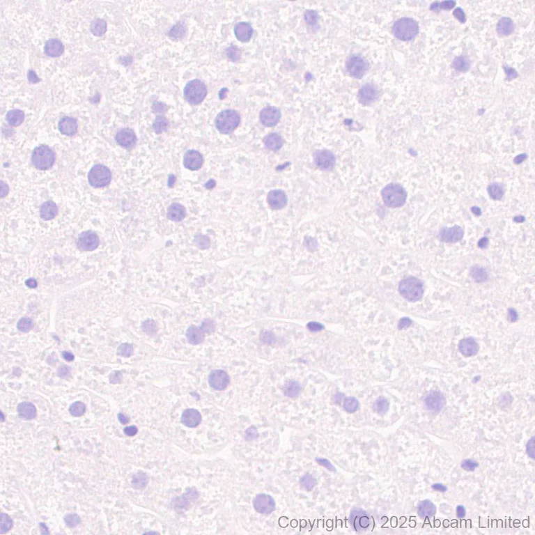 Immunohistochemistry (Formalin/PFA-fixed paraffin-embedded sections) - Anti-FGF13 antibody [EPR29561-52] (AB325168)