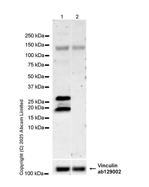 Western blot - Anti-FGF13 antibody [EPR29561-52] (AB325168)