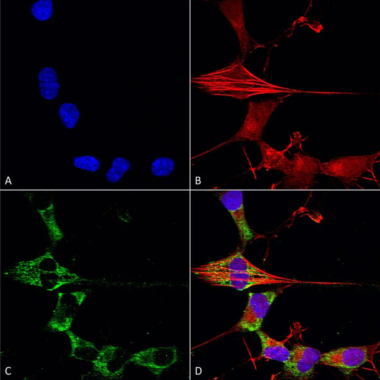 Immunocytochemistry/ Immunofluorescence - Anti-FGF13 antibody [N235/22] (AB186300)