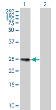 Western blot - FGF13 overexpression 293T lysate (whole cell) (AB94178)