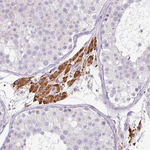Immunohistochemistry (Formalin/PFA-fixed paraffin-embedded sections) - Anti-FGF17 antibody (AB187982)