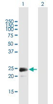 Western blot - Anti-FGF18 antibody (AB169615)