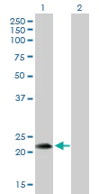Western blot - Anti-FGF19 antibody (AB172545)
