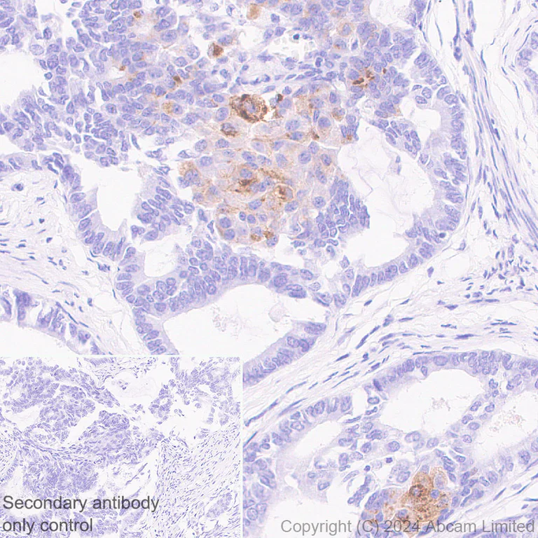 Immunohistochemistry (Formalin/PFA-fixed paraffin-embedded sections) - Anti-FGF19 antibody [EPR29017-89] (AB320829)