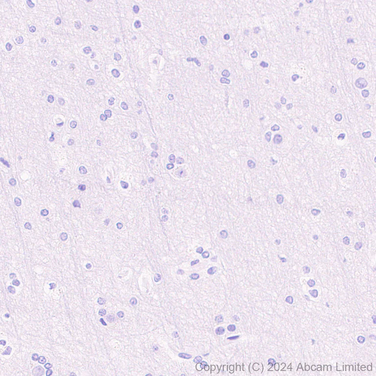 Immunohistochemistry (Formalin/PFA-fixed paraffin-embedded sections) - Anti-FGF19 antibody [EPR29017-89] (AB320829)