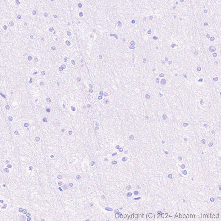 Immunohistochemistry (Formalin/PFA-fixed paraffin-embedded sections) - Anti-FGF19 antibody [EPR29017-89] - BSA and Azide free (AB320830), expandable thumbnail