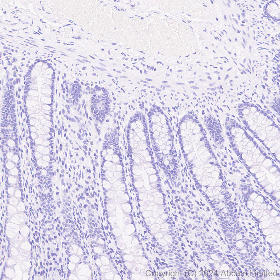 Immunohistochemistry (Formalin/PFA-fixed paraffin-embedded sections) - Anti-FGF19 antibody [EPR29017-89] - BSA and Azide free (AB320830), expandable thumbnail