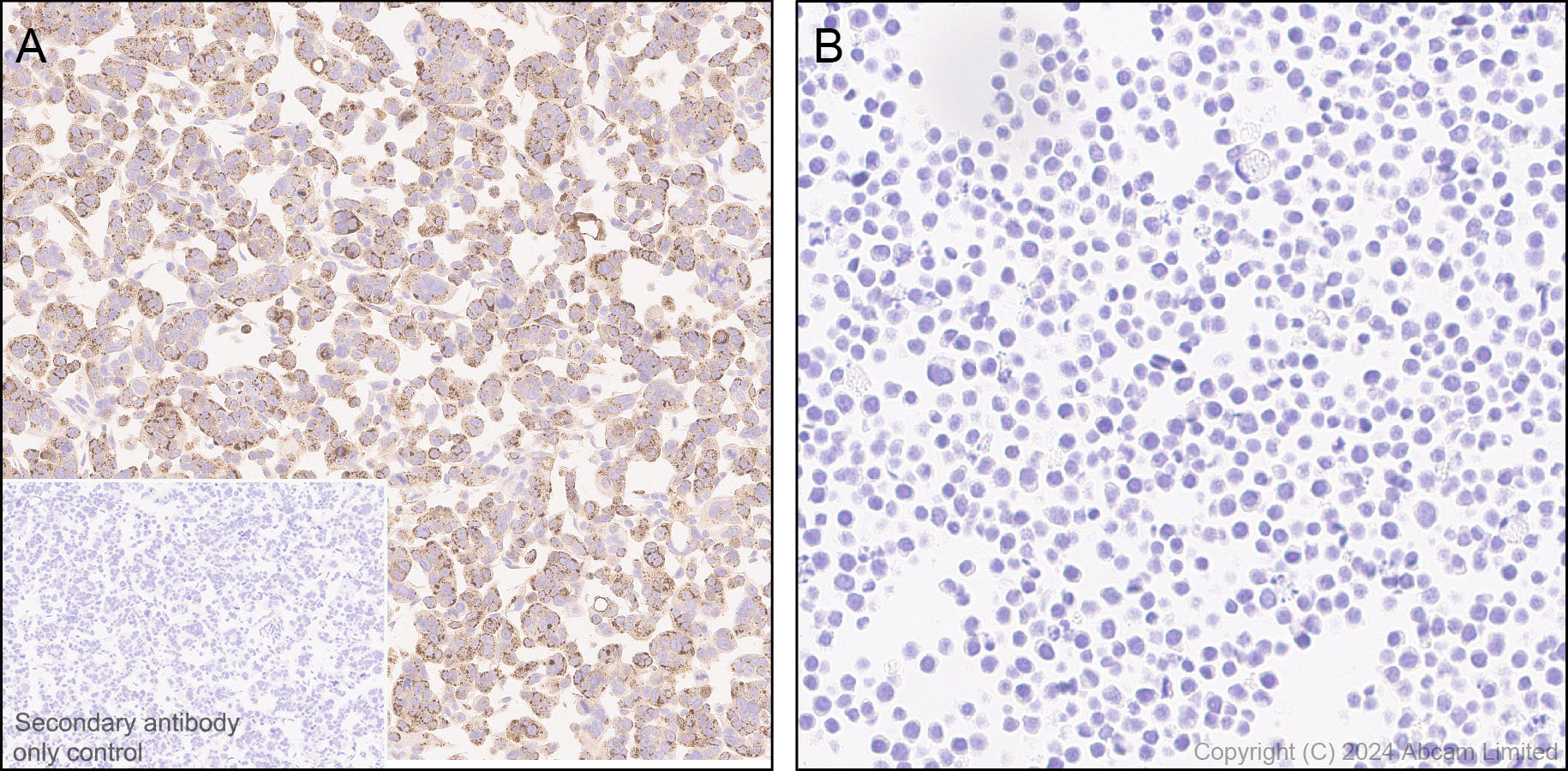 Immunohistochemistry (Formalin/PFA-fixed paraffin-embedded sections) - Anti-FGF19 antibody [EPR29017-89] - BSA and Azide free (AB320830), expandable thumbnail