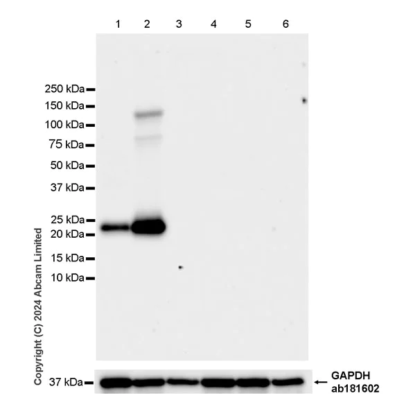 Western blot - Anti-FGF19 antibody [EPR29017-89] - BSA and Azide free (AB320830)
