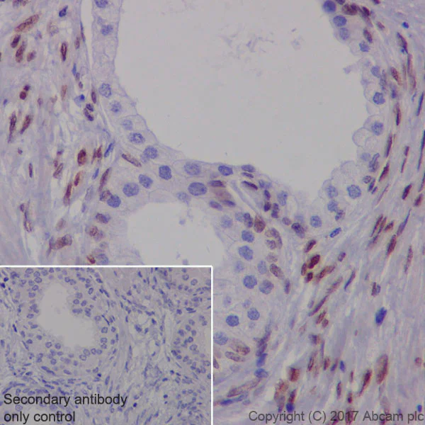 Immunohistochemistry (Formalin/PFA-fixed paraffin-embedded sections) - Anti-FGF2 antibody [EP1735] (AB92337)