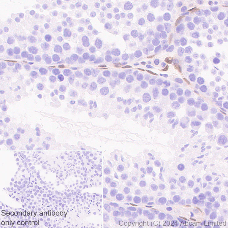 Immunohistochemistry (Formalin/PFA-fixed paraffin-embedded sections) - Anti-FGF2 antibody [EPR29019-77] (AB321990)