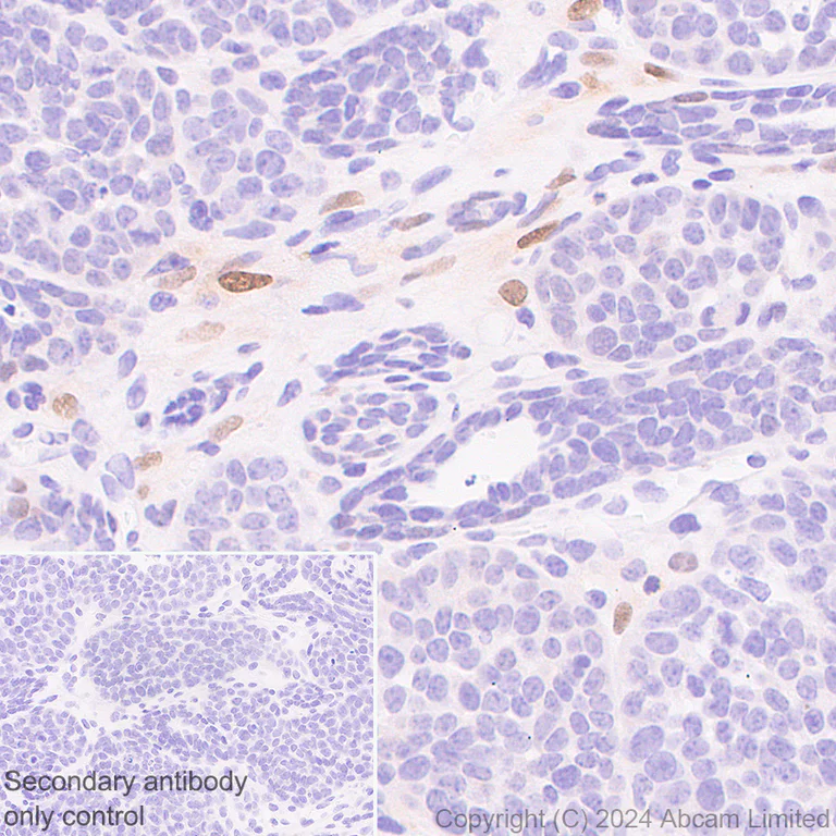 Immunohistochemistry (Formalin/PFA-fixed paraffin-embedded sections) - Anti-FGF2 antibody [EPR29019-77] (AB321990)