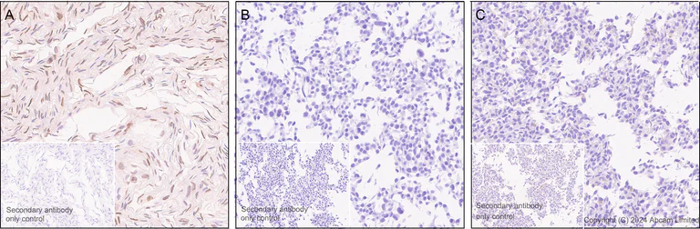 Immunohistochemistry (Formalin/PFA-fixed paraffin-embedded sections) - Anti-FGF2 antibody [EPR29019-77] (AB321990)