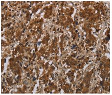 Immunohistochemistry (Formalin/PFA-fixed paraffin-embedded sections) - Anti-FGF20 antibody (AB198876), expandable thumbnail