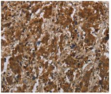 Immunohistochemistry (Formalin/PFA-fixed paraffin-embedded sections) - Anti-FGF20 antibody (AB198876)
