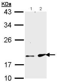 Western blot - Anti-FGF21 antibody (AB137715), expandable thumbnail