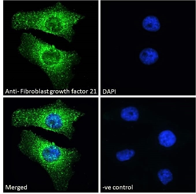 Immunocytochemistry/ Immunofluorescence - Anti-FGF21 antibody (AB77692)