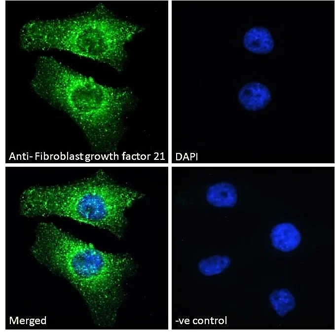 Immunocytochemistry/ Immunofluorescence - Anti-FGF21 antibody (AB77692)