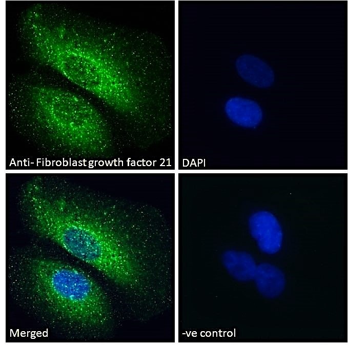 Immunocytochemistry/ Immunofluorescence - Anti-FGF21 antibody (AB77692)