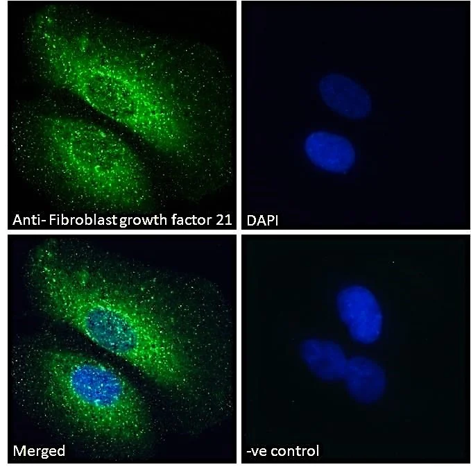 Immunocytochemistry/ Immunofluorescence - Anti-FGF21 antibody (AB77692)