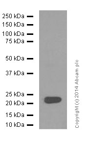 Western blot - Anti-FGF21 antibody [EPR8314(2)] (AB171941), expandable thumbnail