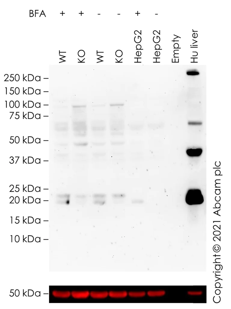 Western blot - Anti-FGF21 antibody [EPR8314(2)] - Low endotoxin, Azide free (AB219368)