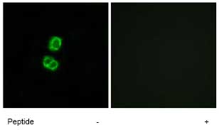 Immunocytochemistry/ Immunofluorescence - Anti-FGF22 antibody (AB74860)