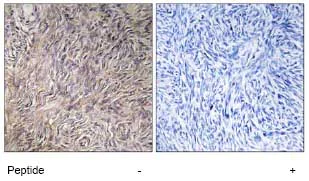 Immunohistochemistry (Formalin/PFA-fixed paraffin-embedded sections) - Anti-FGF22 antibody (AB74860)