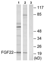 Western blot - Anti-FGF22 antibody (AB74860)