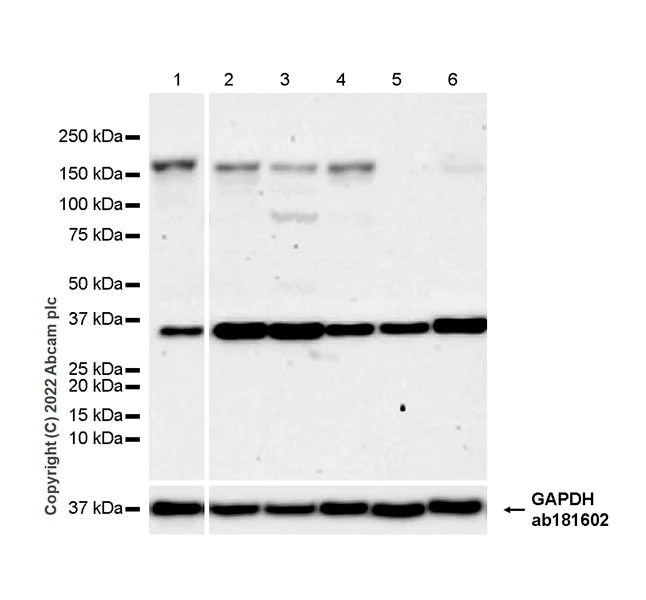 Western blot - Anti-FGF23 antibody [EPR25309-57] - BSA and Azide free (AB307421)
