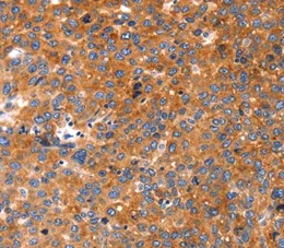 Immunohistochemistry (Formalin/PFA-fixed paraffin-embedded sections) - Anti-FGF3 antibody (AB198201)