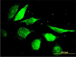 Immunocytochemistry/ Immunofluorescence - Anti-FGF5 antibody (AB168743)