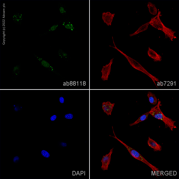 Immunocytochemistry/ Immunofluorescence - Anti-FGF5 antibody (AB88118), expandable thumbnail