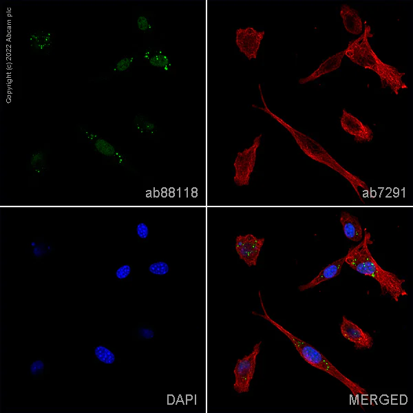 Immunocytochemistry/ Immunofluorescence - Anti-FGF5 antibody (AB88118)