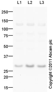 Western blot - Anti-FGF5 antibody (AB88118), expandable thumbnail