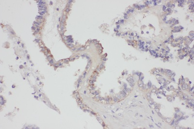 Immunohistochemistry (Formalin/PFA-fixed paraffin-embedded sections) - Anti-FGF8 antibody (AB81384), expandable thumbnail