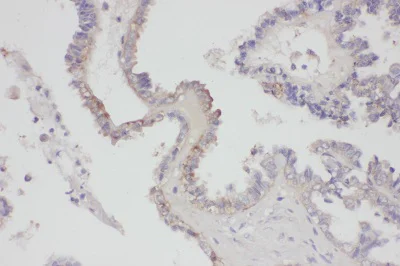 Immunohistochemistry (Formalin/PFA-fixed paraffin-embedded sections) - Anti-FGF8 antibody (AB81384)