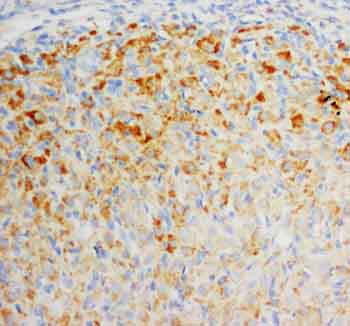 Immunohistochemistry (Formalin/PFA-fixed paraffin-embedded sections) - Anti-FGF8 antibody (AB81384), expandable thumbnail
