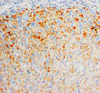 Immunohistochemistry (Formalin/PFA-fixed paraffin-embedded sections) - Anti-FGF8 antibody (AB81384)