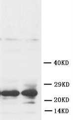 Western blot - Anti-FGF8 antibody (AB81384), expandable thumbnail