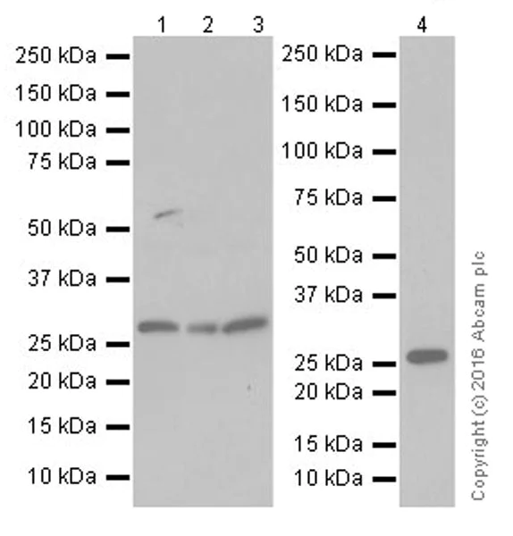 Western blot - Anti-FGF9/GAF antibody [EPR19937] (AB206408)