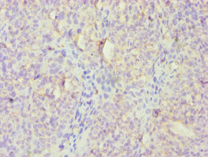 Immunohistochemistry (Formalin/PFA-fixed paraffin-embedded sections) - Anti-FGFBP1 antibody (AB238155)
