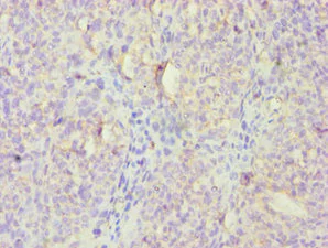 Immunohistochemistry (Formalin/PFA-fixed paraffin-embedded sections) - Anti-FGFBP1 antibody (AB238155)
