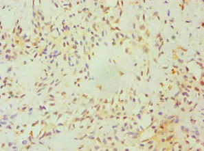 Immunohistochemistry (Formalin/PFA-fixed paraffin-embedded sections) - Anti-FGFBP1 antibody (AB238155)