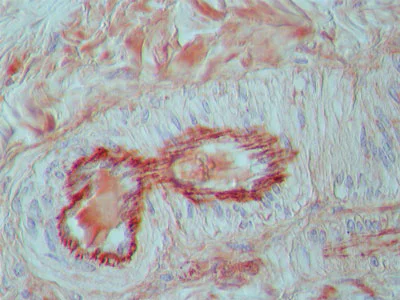 Immunohistochemistry (Formalin/PFA-fixed paraffin-embedded sections) - Anti-FGFR1 antibody (AB10646)