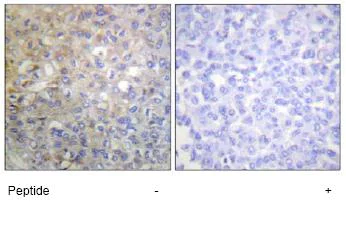 Immunohistochemistry (Formalin/PFA-fixed paraffin-embedded sections) - Anti-FGFR1 antibody (AB63601)